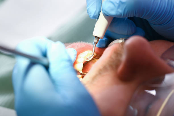 Best Emergency Dental Care for Broken or Chipped Teeth in Taylorsville, KY
